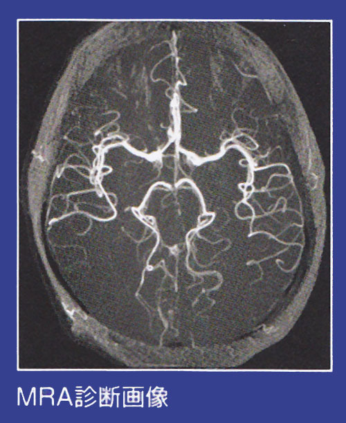 MRA診断画像例１
